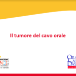 IL TUMORE DEL CAVO ORALE